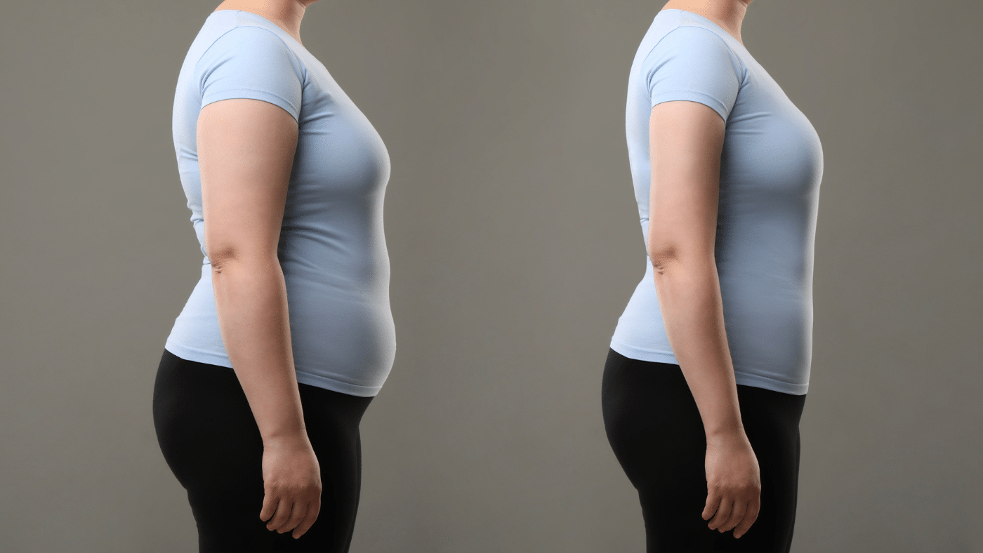 doctor led weight loss Ireland